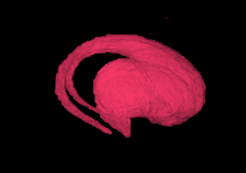 Dorsal striatum mask