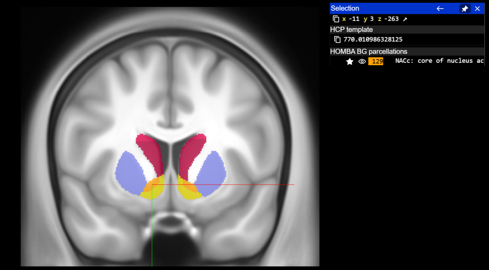 Human GPe neuroglancer