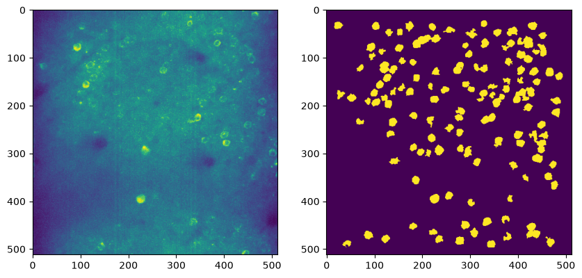 <Figure size 1000x3000 with 2 Axes>
