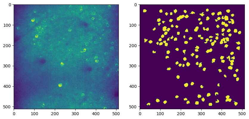<Figure size 1000x3000 with 2 Axes>